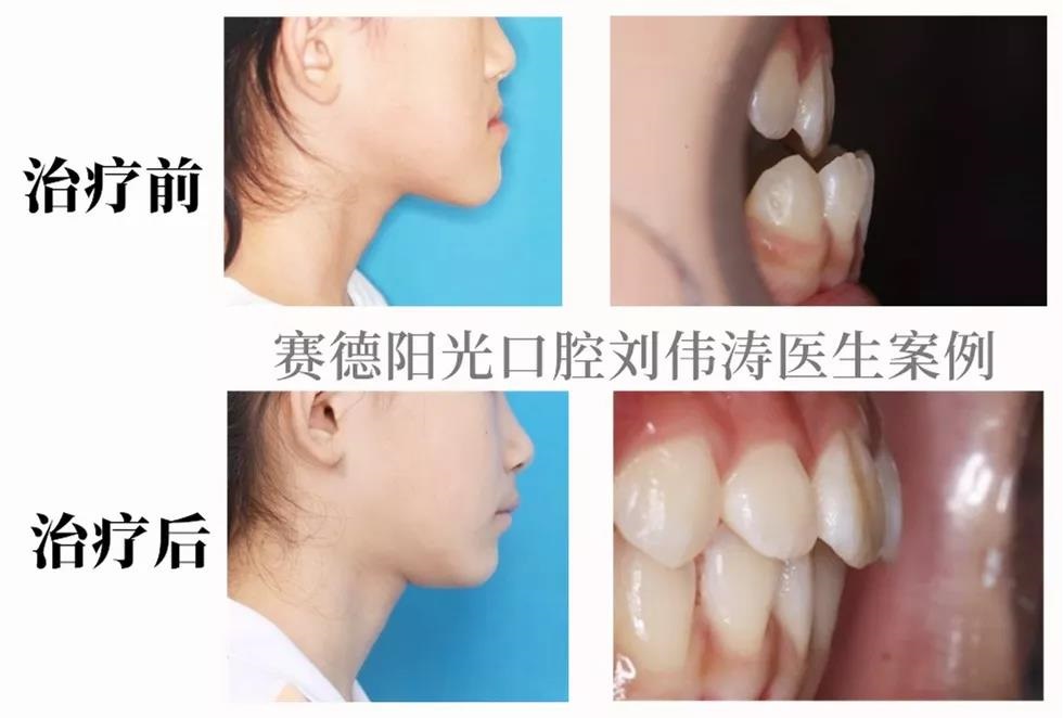 刘伟涛医生患者案例