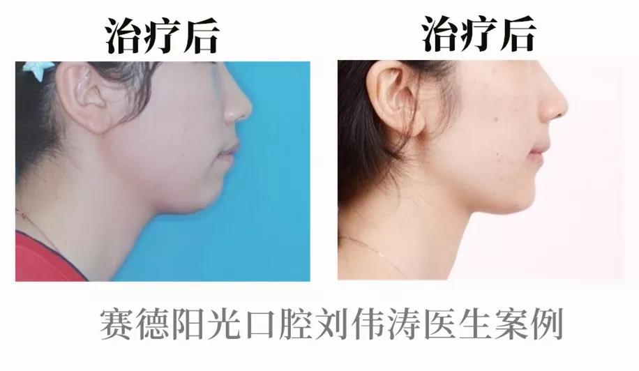 刘伟涛医生患者案例