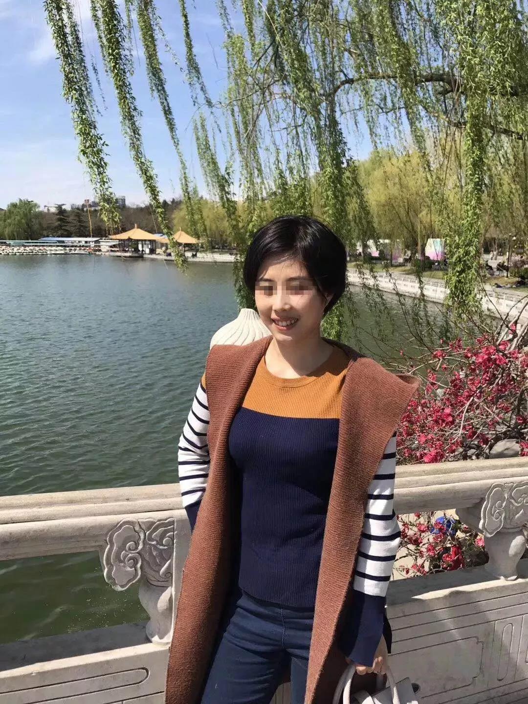 牙齿矫正后