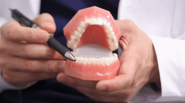 想让这些牙齿“立正站好”的办法，叫做，正畸