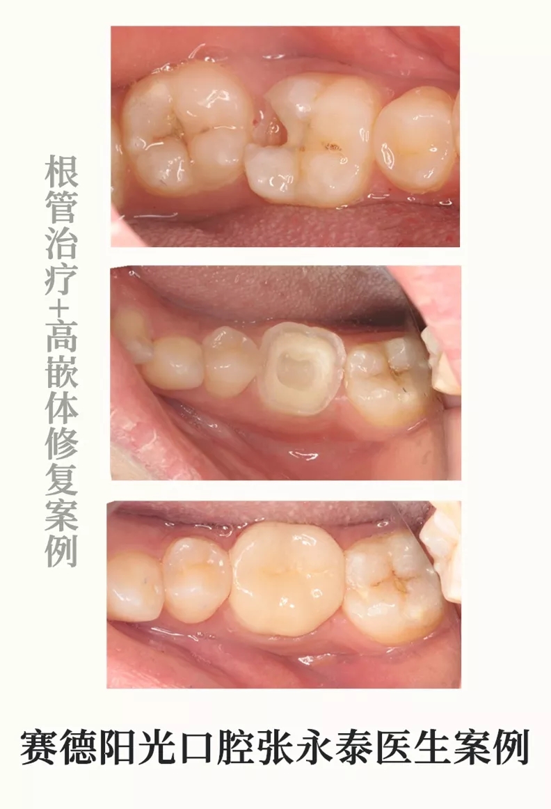 张永泰医生案例