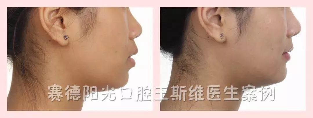 王斯维医生案例
