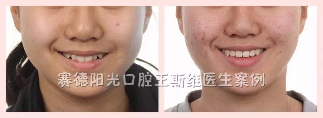 王斯维医生案例