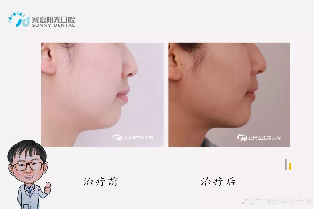 北京大学口腔正畸学博士常大桐医生简介
