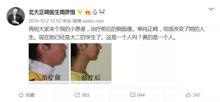 周彦恒教授正畸案例