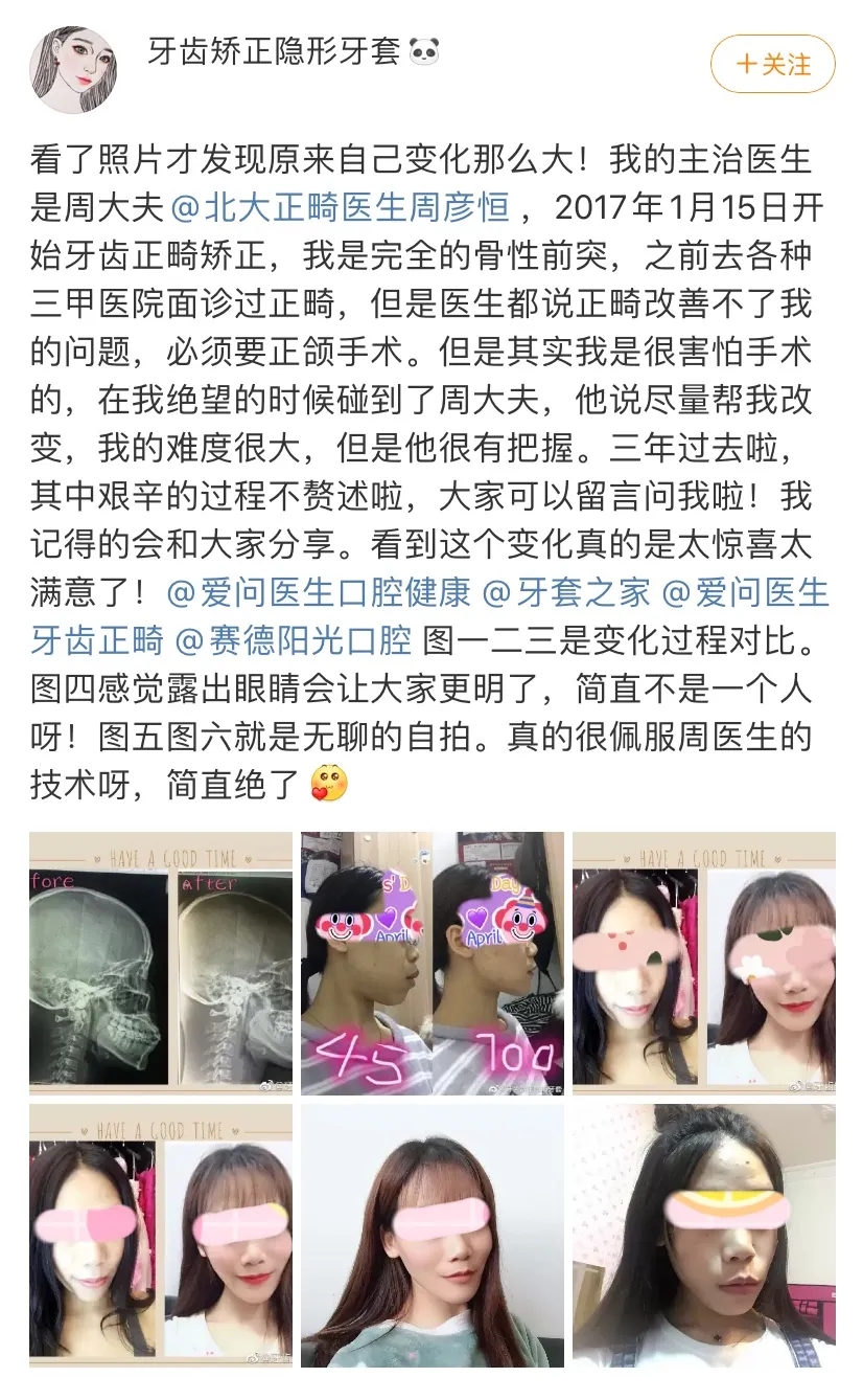 “隐适美坚持记”活动获奖名单