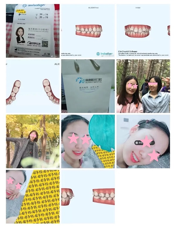 “隐适美坚持记”活动获奖名单