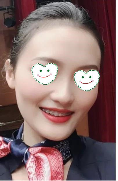 很关心我牙齿的情况,让我觉得很暖心。