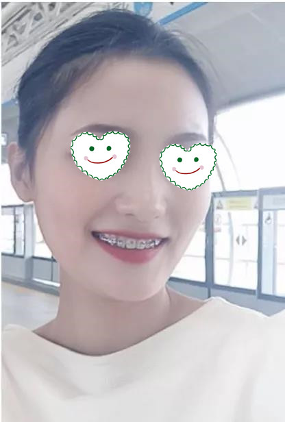 很关心我牙齿的情况,让我觉得很暖心。
