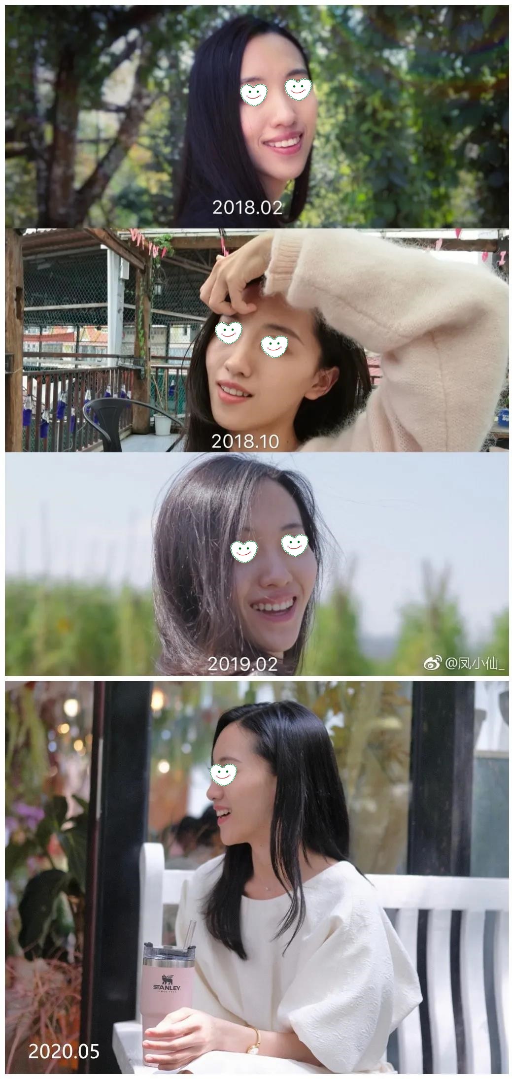 正畸过程中的变化